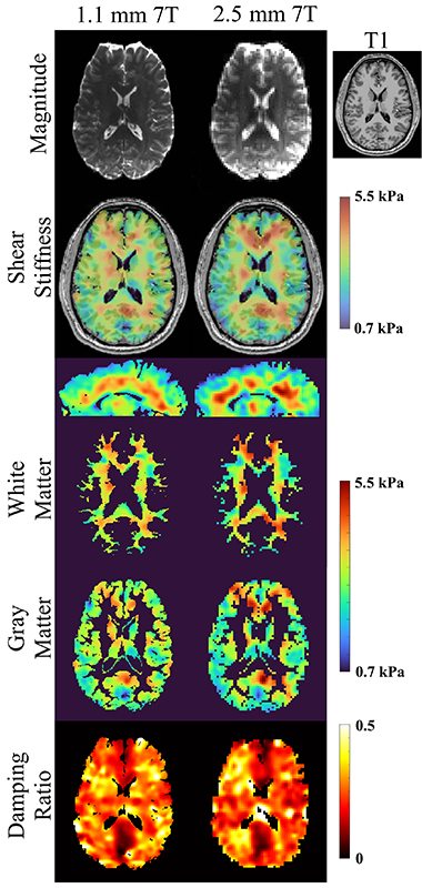 Examples of brain scans using the MRI machine with high field strength, with different colors indicating the stiffness level of the part of the brain.