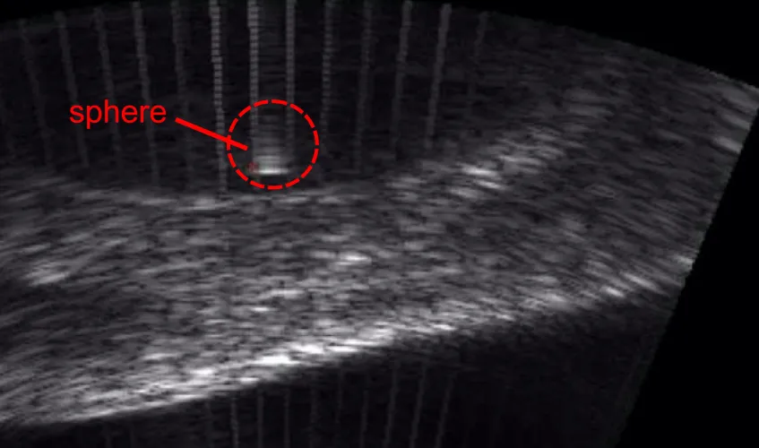 ultrasound image labeled "sphere" as an indication of where the small glass sphere is inside a bladder