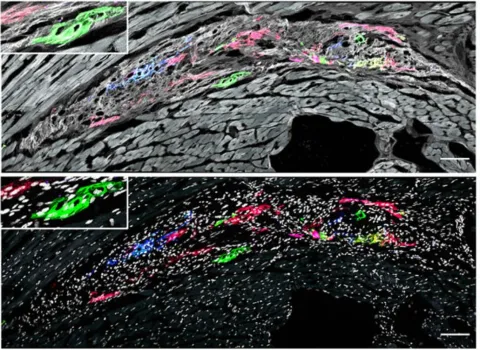 Image of rainbow reporter cardiomyocytes six weeks after engraftment - colored speckles on a black and white tissue image