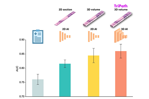 Bar chart showing the clinical baseline at approximately 0.76, 2D AI on a 2D section at approximately 0.82, 2D AI on a 3D volume at approximately 0.84, and TriPath, 3D AI on a 3D volume, at approximately 0.86.